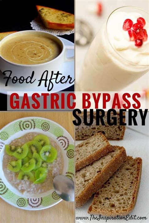 What To Eat After Gastric Bypass Surgery Gastric Bypass Surgery Bariatric Recipes Food