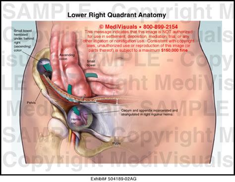 The liver is a large, meaty organ that sits on the right side of the belly. Lower Right Quadrant Anatomy Medical Exhibit