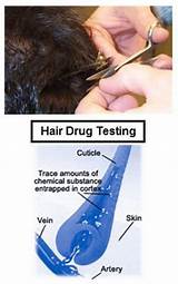 Hair Drug Test Marijuana Photos