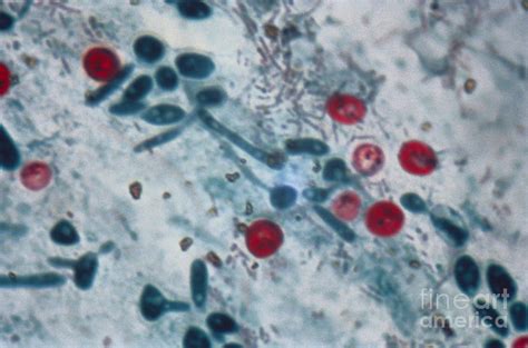 Parvum genotype i) are the leading causes of human cryptosporidiosis. Cryptosporidium Parvum Lm Photograph by Science Source