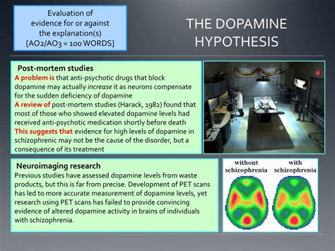 Ppt Schizophrenia Powerpoint Presentation Free Download Id9123189