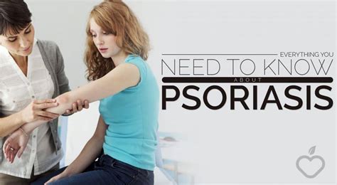 Everything You Need To Know About Psoriasis Positive Health Wellness