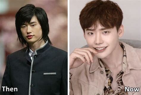 Pinocchio Actor Lee Jong Suk Plastic Surgery Before And After