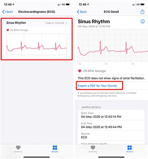 How To Use Apple Watch Ecg Feature Effectively