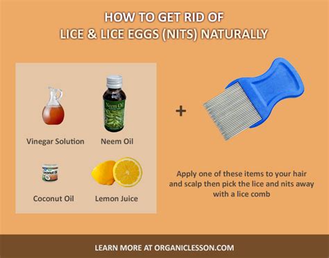 How To Get Rid Of Head Lice And Eggs With Natural Home Remedies Lice