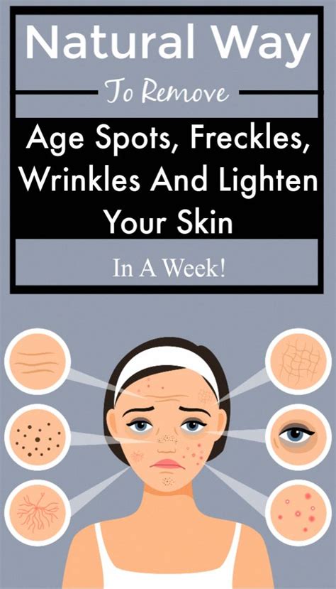Healthy Natural Way To Remove Age Spots Freckles Wrinkles And Lighten