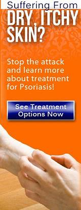 New Psoriasis Treatment Pill Images