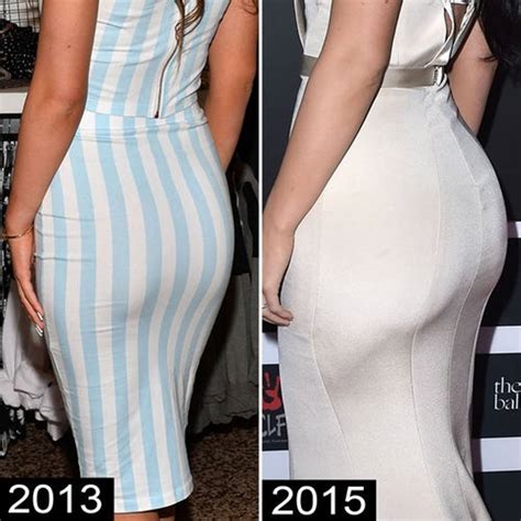 Kylie Jenner Before And After Plastic Surgery Photos Reveal Drastic
