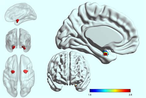 Amígdala Cerebral Qué Es Funciones Y Anatomía