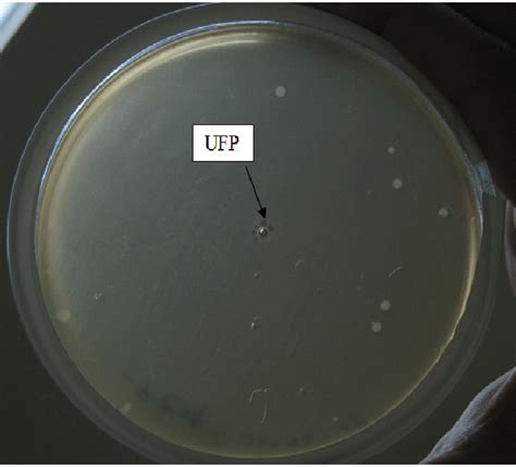 Observación de lisis generada por los bacteriófagos obtenidos a partir