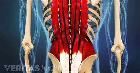 Understanding Lower Back Strain