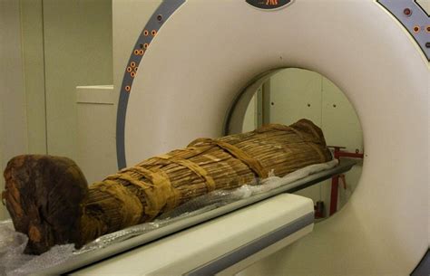 Cat scan diagnostic exams are performed to spot any unusual occurrences that are happening in the human body. Ancient people had clogged arteries, too, mummy CT scans ...