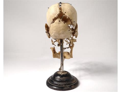 Skull Burst With Beauchêne Anatomy House Tramond Paris Medicine Nineteenth