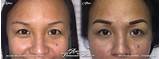 Images of Permanent Makeup Orange County