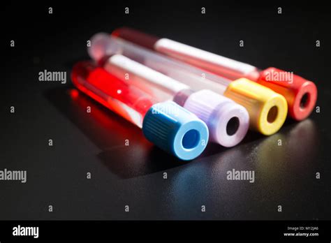 Vacutainer Blood Tubes High Resolution Stock Photography And Images Alamy