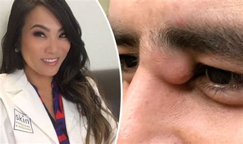 Dr Pimple Popper Returns With Her Most Gruesome Video Yet As She Bursts