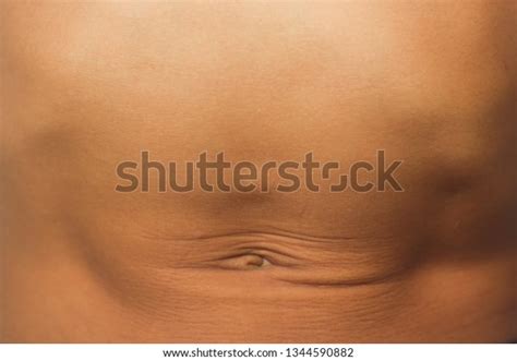 Child Showing His Epigastric Hernia Intestinal Stock Photo Edit Now