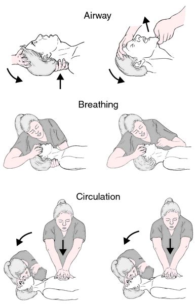 Mouth To Mouth Resuscitation Definition Of Mouth To Mouth Resuscitation By Medical Dictionary