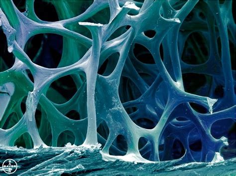 The infobox for that structure appears on the left of the screen. Electron microscope view of bone tissue | Microscopic ...