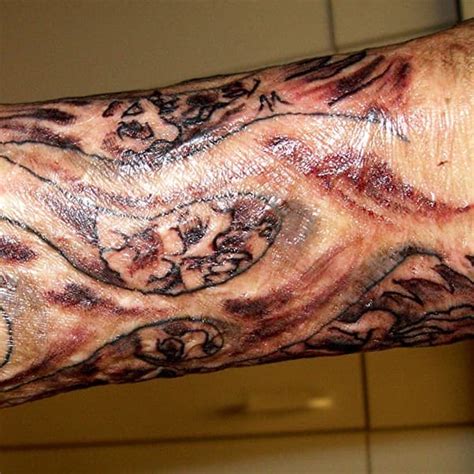 Tattoos On Burned Scarred Or Grafted Skin Tatring