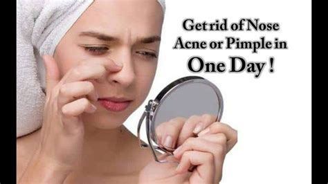 How To Get Rid Of Nose Pimples Fast Nose Acne Treatment Natural And