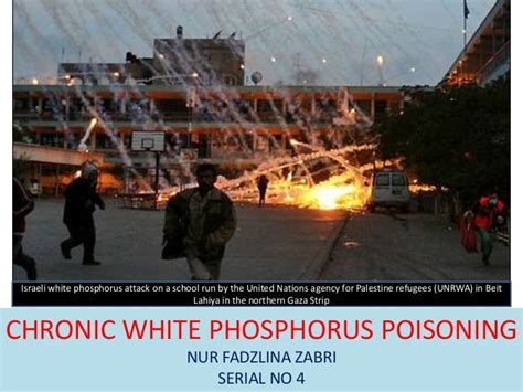 Chronic White Phosphorus Poisoning
