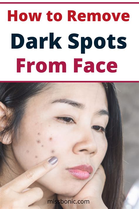 how to remove dark spots from face remove dark spots acne dark spots how to remove