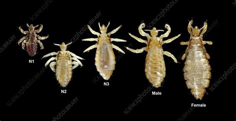 Body Lice Stock Image C0211055 Science Photo Library