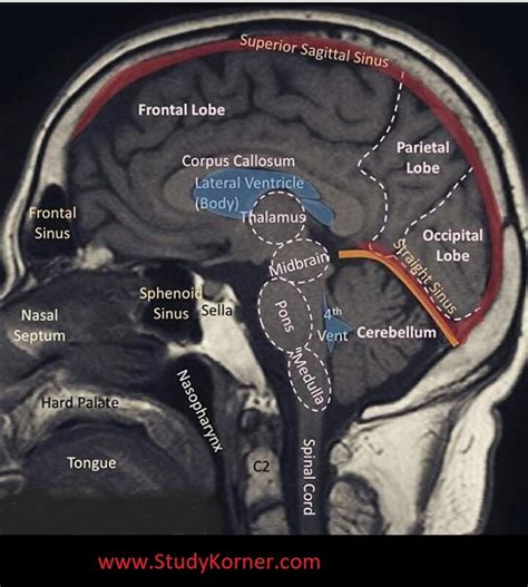 Well Labelled Mri Of The Brain Radiology Radiology Student Nurse