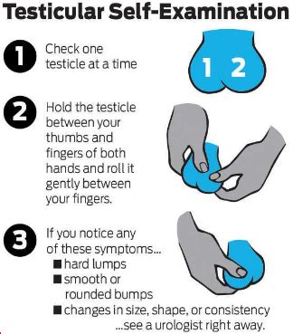 It's not clear what causes testicular cancer in most cases. Advanced Testicular Cancer Symptoms