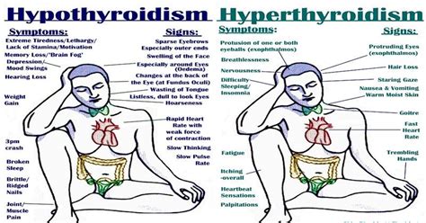 Hypo Vs Hyperthyroidism All The Signs Symptoms Triggers And Treatments Save Your Health