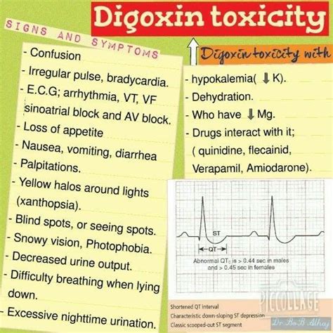 Digoxin Toxicity What To Do Nursing School Tips Pharmacology