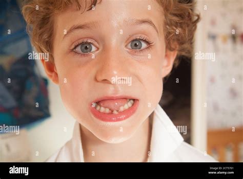 Five Year Old Boy With A Wobbly Front Tooth Hampshire England United