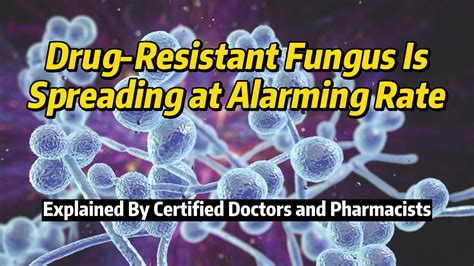 Cdc Warns Of Drug Resistant Fungus Spreading At Alarming Rate