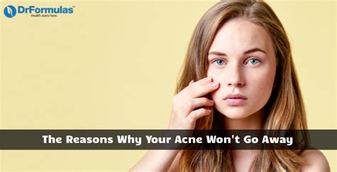 Heres Why Your Acne Wont Go Away And What To Do Drformulas