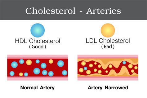 What is a healthy cholesterol level? New Guidelines Show Us