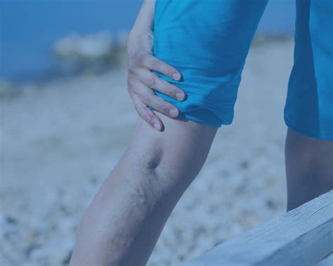 Understanding The Basics Why Do I Have Leg Pain Blog South Valley