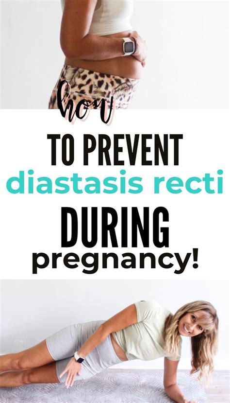 How To Effectively Prevent Diastasis Recti During Pregnancy Artofit