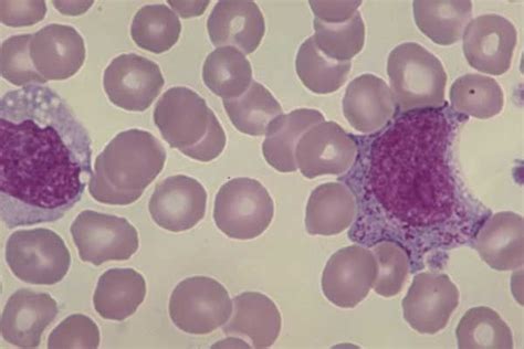 Monocyte Neutrophilic Myelocyte Normal Marrow Medical Laboratory