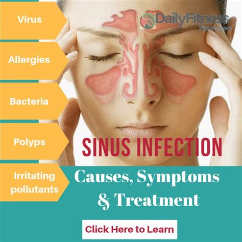 Sinus Infection Causes Picture Symptoms And Treatment