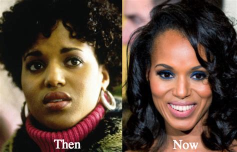 Kerry Washington Plastic Surgery Before And After Photos Latest