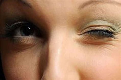 what causes twitching in left eye and how to treat it md