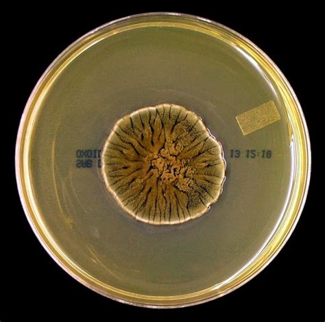 Fun With Microbiology Whats Buggin You Cladosporium Species