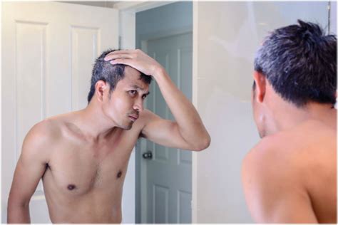 causes of premature greying of hair the statesman