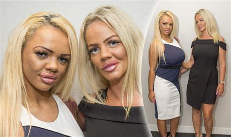 Mother Daughter Or Sisters Pair Reveal How Much They Spent On Surgery Life Life And Style