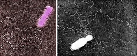 Bartonella Bacilliformis Scheda Batteriologica E Approfondimenti