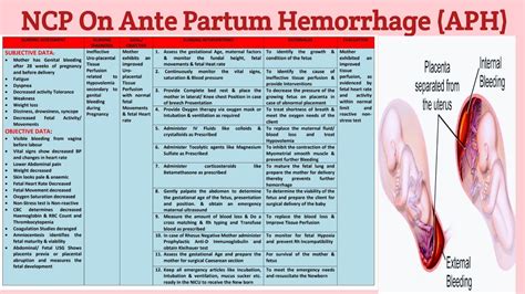 NCP 29 Nursing Care Plan On Ante Partum Hemorrhage APH YouTube
