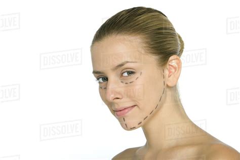Woman With Plastic Surgery Markings On Face Smiling At Camera Stock