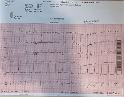 Help With Ekg Results Cardio Files