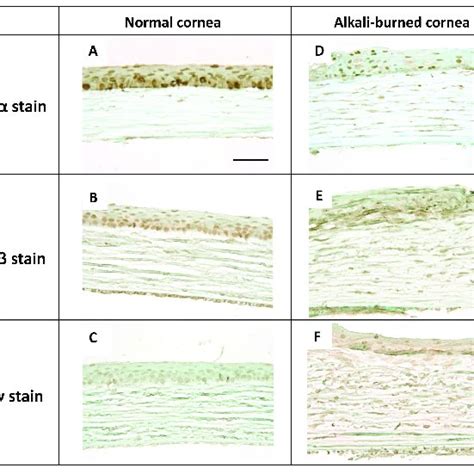 The Expression Of Peroxisome Proliferator Activated Receptors PPARs